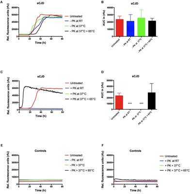 Optimization of the Real-Time Quaking-Induced Conversion Assay for Prion Disease Diagnosis